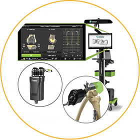 Robotic Total and Partial Knee Replacement