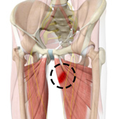 Hip Adductor Injuries