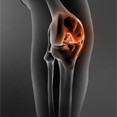 Knee Cartilage Restoration